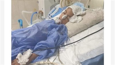 بعد معاناة ١٧ يوما والتحقيق مع ٦ أطباء..وفاة الطفلة نورهان بمستشفي طنطا الجامعى 