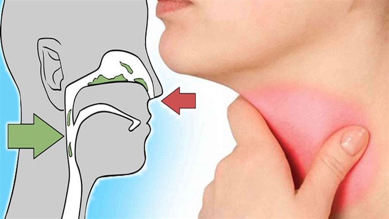 علاج البلغم في الحلق
