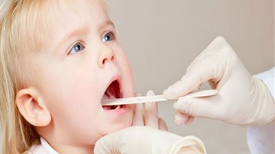 تعرف على أعراض الحمى الروماتيزمية وطرق العلاج