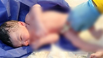 نجاح أول حالة ولادة طبيعية لسيدة في نموذج مستشفى مُصغر بمصر