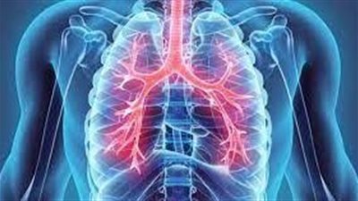 8 أعراض للإصابة بأورام الرئة