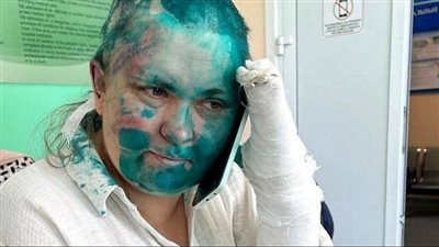 اعتداء وحشي وتهديدات بالقتل لصحفية انتقدت رئيس الشيشان