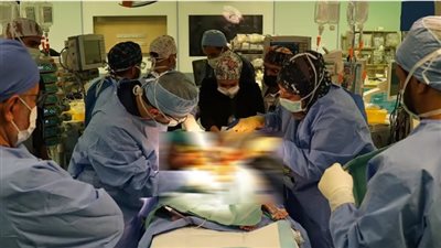  بدء عملية فصل التوأم السيامي السوري إحسان وبسام في السعودية (صور)