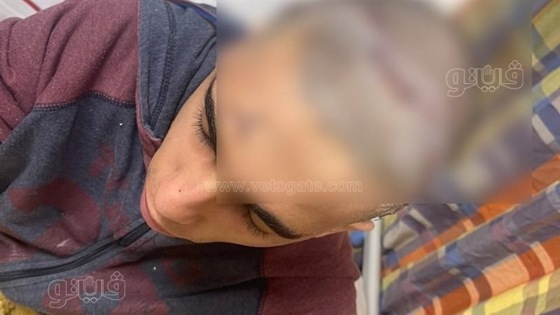 لاعب كرة القدم المصاب،