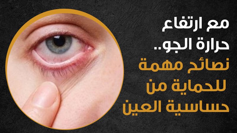 اعراض حساسية العين،