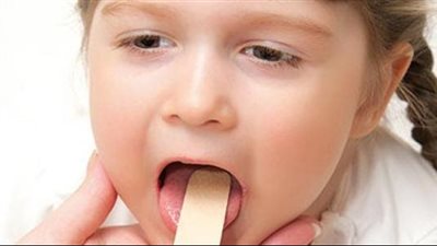 أعراض التهاب الحلق عند الأطفال وأنواعه وطرق العلاج