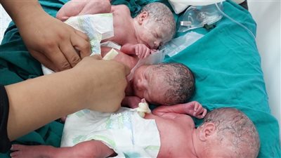 ولادة للمرة الخامسة، سيدة تضع ثلاثة أطفال توأم بالمنوفية
