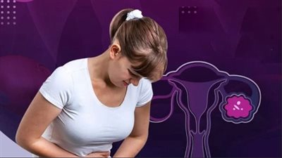 تكيس المبايض، مرض العصر للسيدات ويهدد بالحرمان من الإنجاب 