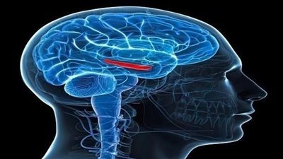 اليوم العالمي للدماغ 2023، 5 أمراض عصبية تسبب 9 ملايين وفاة سنويًا 