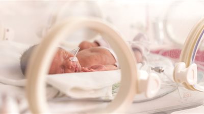 خطورة تعرض الرضع لجلسات الأكسجين وتأثيره في العين