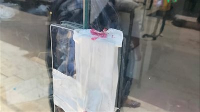 إزالة 5 حالات تعدٍّ وغلق 5 محال لإدارتها بدون ترخيص بالإسماعيلة (صور)