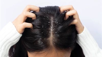 هيئة الدواء تحذر من منتجات تصفيف الشعر لهذا السبب