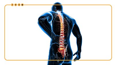 الفئات الأكثر عرضة لآلام الظهر وهذه أهم الأسباب (إنفوجراف)