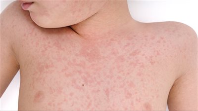 كيف تؤثر الرطوبة على جودة الهواء؟ (إنفوجراف)