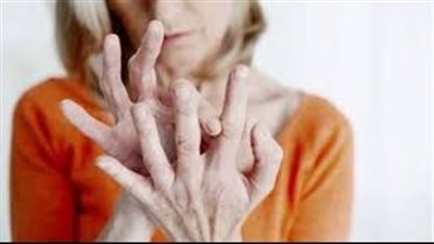 أعراض الروماتيزم عند النساء، ولماذا المرض أكثر انتشارا عند السيدات؟ 
