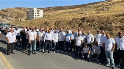 تدشين رابطة للصلع في الأردن، ما القصة ؟