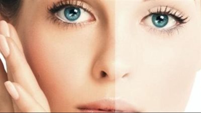 قناع طبيعي يحارب اسمرار البشرة ويجعلها صافية وناعمة مثل الأطفال