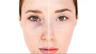 قناع النشاء وماء الورد للتخلص من تصبغات البشرة