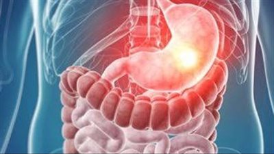 دراسة طبية حديثة: زيادة معدلات الإصابة بالسرطان لدى الأشخاص الأقل من 50 عاما 