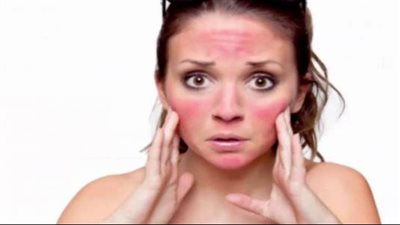 تخلصي من آثار الشمس والهالات السوداء على البشرة بماء البطاطس 