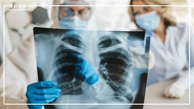 عدوى الفيلقية.. مرض خطير يضرب بولندا (فيديوجراف)