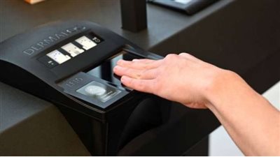 جراحة لأصابع اليد، الكويت تكشف عن حيلة ذكية للوافدين لدخول البلاد وتهددهم بهذا الإجراء