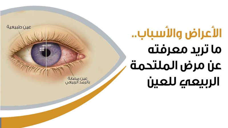 حساسية العين، فيتو