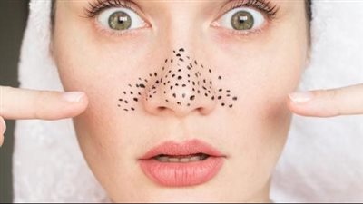 تخلصي من البثور السوداء بالجيلاتين والحليب