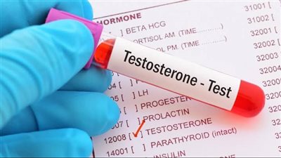 طرق علاج ارتفاع هرمون التستوستيرون لدى النساء 