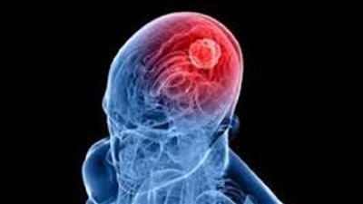 منها متلازمة كوشينج والأورام، اضطرابات الغدة النخامية وأعراض كلًا منها 