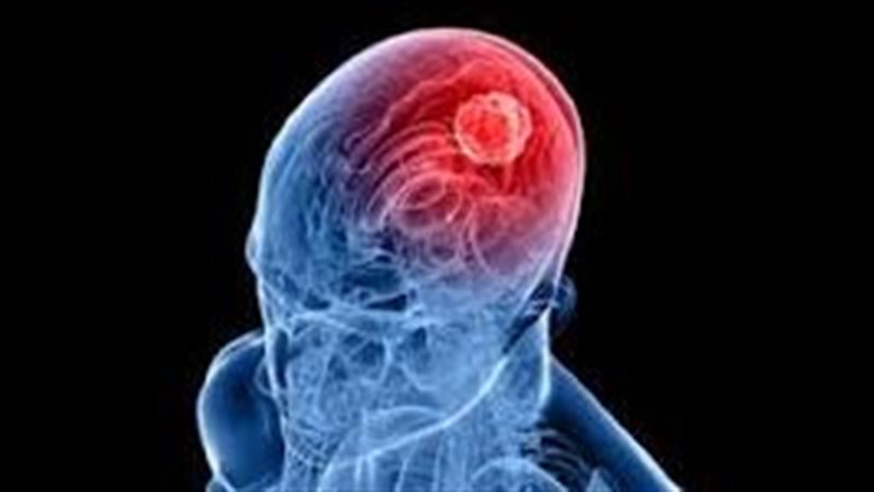 اضطرابات الغدة النخامية،