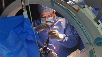 مستشفى جامعة طنطا تجري عملية جراحية في المخ لمدة ساعة 12 ساعة