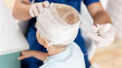 تفسير حلم الضرب على الرأس في المنام وعلاقته بالخير الكثير 