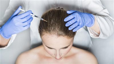 علاج تساقط الشعر، بتقنية فيلر الشعر في أسرع وقت