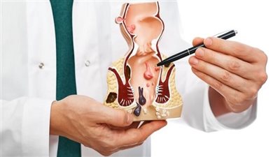 أعراض وأسباب الناسور الشرجي، ومتى تكون الجراحة ضرورية؟