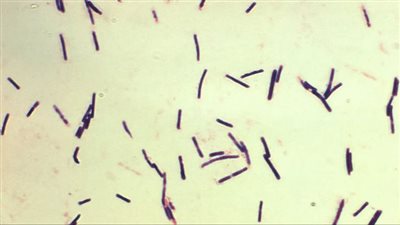 مرض غامض يفتك بالعشرات في بلد أفريقي، 
