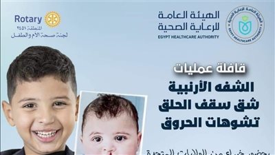 الرعاية الصحية تنظم قافلة للعمليات الطبية لعلاج التشوهات الخلقية بالأقصر 