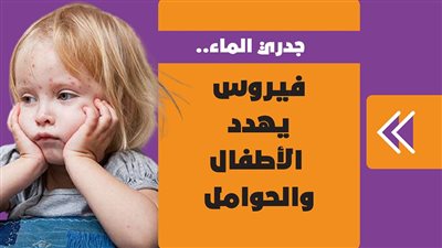 جدري الماء.. فيروس يهدد الأطفال والحوامل | فيديو جراف 