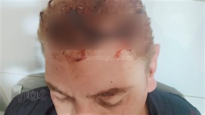 محام يعتدي على زميله بسلاح أبيض أمام قاعة جلسات مجمع محاكم طنطا