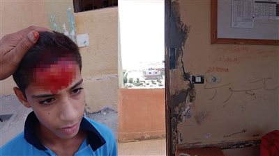سقف الفصل وقع عليه.. إصابة طالب بقطع في الرأس بشمال سيناء | صور