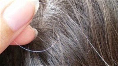 تخلصى من الشعر الأبيض بهذه المكونات الطبيعية 