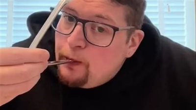 عنده وسواس، رجل غير قادر على لمس الطعام بيده ويتناوله بملقاط معدني 