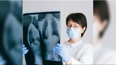  ضربة قاضية للذكاء الاصطناعي على يد أطباء، ما حدث 