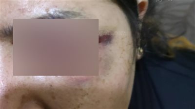 شهود عيان: أسرة 