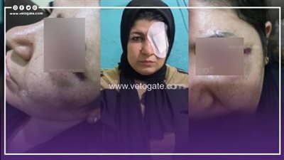 ممرضة السلام تكشف كيف تم إنقاذ حياتها من بطش تاجر المخدرات بعد فقء عينها (فيديو وصور)