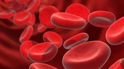 أعراض فقر الدم، وأسباب الإصابة وطرق العلاج