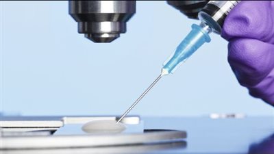 أرغب في إجراء عملية حقن مجهري لزوجتي وتحديد نوع الجنين فهل يجوز ذلك شرعًا؟ 