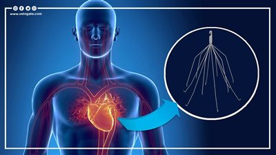  8 أعراض للإصابة بجلطات الرئة (إنفوجراف)