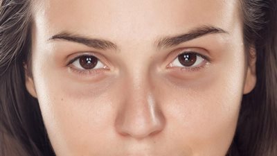 وصفة طبيعية تساعد فى تقليل الهالات السوداء 