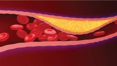  برودة أصابع القدمين واليدين، مؤشر للإصابة بهذا المرض ونصائح للوقاية منه 